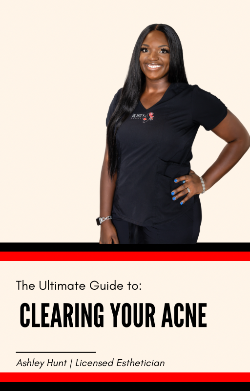 Clearing your acne EBOOK